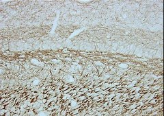 Anti-Neurofilament 160 kDa Antibody, clone NN18 clone NN18, Chemicon®, from mouse