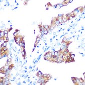 Anti-IMP3 Antibody, clone 8K4H5, Rabbit Monoclonal