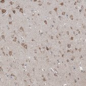 Anti-DHX30 antibody produced in rabbit Prestige Antibodies® Powered by Atlas Antibodies, affinity isolated antibody, buffered aqueous glycerol solution