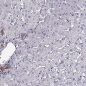 Anti-ISYNA1 antibody produced in rabbit Prestige Antibodies® Powered by Atlas Antibodies, affinity isolated antibody, buffered aqueous glycerol solution