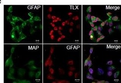 抗MAP2（2a+2b）抗体、マウスモノクローナル マウス宿主抗体 ~2 mg/mL, clone AP-20, purified from hybridoma cell culture
