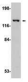 Anti-SAPAP4 Antibody from rabbit, purified by affinity chromatography