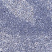 Anti-BDH1 antibody produced in rabbit Prestige Antibodies® Powered by Atlas Antibodies, affinity isolated antibody, buffered aqueous glycerol solution