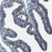 Anti-STIM1 antibody produced in rabbit Prestige Antibodies® Powered by Atlas Antibodies, affinity isolated antibody, buffered aqueous glycerol solution