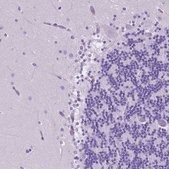 Anti-IGFN1 antibody produced in rabbit Prestige Antibodies® Powered by Atlas Antibodies, affinity isolated antibody, buffered aqueous glycerol solution