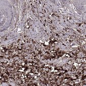 Anti-LUM antibody produced in rabbit Prestige Antibodies® Powered by Atlas Antibodies, affinity isolated antibody, buffered aqueous glycerol solution