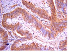 Anti-PI3 Kinase Antibody, p110β from rabbit, purified by affinity chromatography