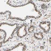 Anti-GOLGB1 antibody produced in rabbit Ab2, Prestige Antibodies® Powered by Atlas Antibodies, affinity isolated antibody, buffered aqueous glycerol solution