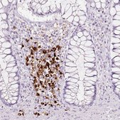 Anti-LAMP3 antibody produced in rabbit Prestige Antibodies® Powered by Atlas Antibodies, affinity isolated antibody, buffered aqueous glycerol solution